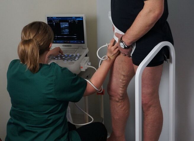 преглед вена пре ласерске коагулације за проширене вене